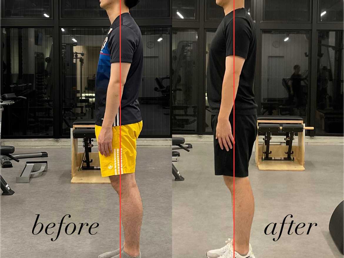 私の男性クライアント。姿勢改善のビフォーアフター写真