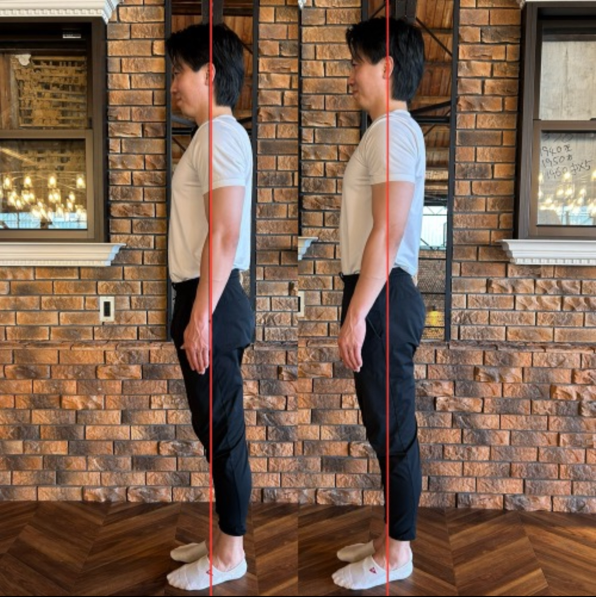 私のお客様。巻き肩改善アプローチ後のビフォーアフター